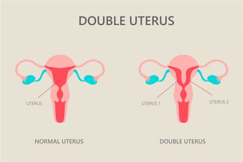 2 vaginas|Woman with uterus didelphys reveals what it’s like to have two。